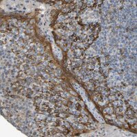 Anti-KIAA1671 antibody produced in rabbit 