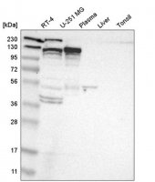 Anti-KIF11 antibody produced in rabbit