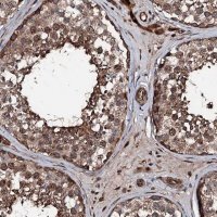 Anti-KIF18A antibody produced in rabbit 