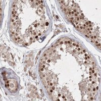 Anti-KIF20A antibody produced in rabbit HPA036909-100UL
