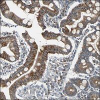 Anti-KIF2C antibody produced in rabbit HPA006432-100UL