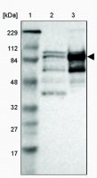 Anti-KIF2C antibody produced in rabbit HPA006432-100UL