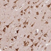 Anti-KLC1 antibody produced in rabbit