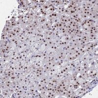 Anti-KLF14 antibody produced in rabbit 