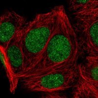 Anti-KLF16 antibody produced in rabbit 