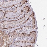Anti-KLF2 antibody produced in rabbit