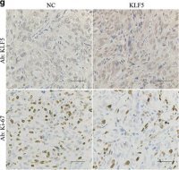 Anti-KLF5 antibody produced in rabbit 