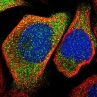 Anti-KLHDC1 antibody produced in rabbit 