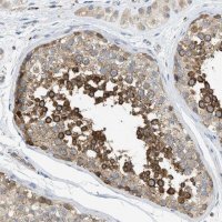 Anti-KLHDC10 antibody produced in rabbit 