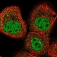 Anti-KLHDC10 antibody produced in rabbit 