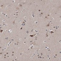 Anti-KLHDC3 antibody produced in rabbit 