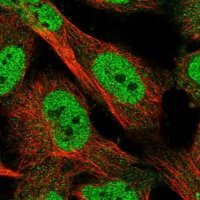 Anti-KLHDC3 antibody produced in rabbit 