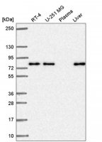 Anti-KLHL29 antibody produced in rabbit HPA057379-100UL