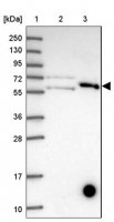 Anti-KLHL29 antibody produced in rabbit HPA049057-100UL