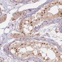 Anti-KLHL36 antibody produced in rabbit 