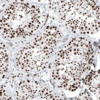 Anti-KMT5C antibody produced in rabbit