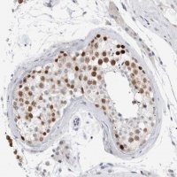 Anti-KNL1 antibody produced in rabbit