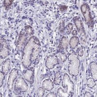 Anti-KNOP1 antibody produced in rabbit HPA041079-100UL