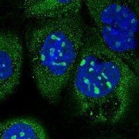 Anti-KNOP1 antibody produced in rabbit HPA041079-100UL