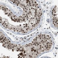Anti-KPNA6 antibody produced in rabbit