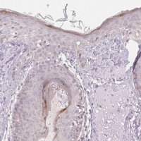 Anti-KPRP antibody produced in rabbit 