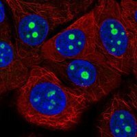Anti-KRI1 antibody produced in rabbit