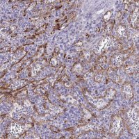 Anti-KRIT1 antibody produced in rabbit 