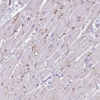 Anti-KRIT1 antibody produced in rabbit 