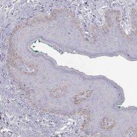 Anti-KRT31 antibody produced in rabbit 