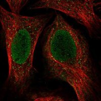 Anti-KRT34 antibody produced in rabbit 