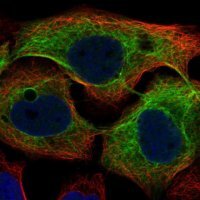 Anti-KRT4 antibody produced in rabbit HPA034881-100UL