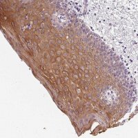 Anti-KRT6A antibody produced in rabbit 