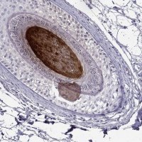 Anti-KRTAP11-1 antibody produced in rabbit 