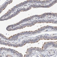 Anti-LACE1 antibody produced in rabbit 
