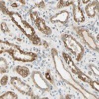 Anti-LAMA3 antibody produced in rabbit