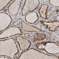 Anti-LAMTOR3 antibody produced in rabbit HPA026858-100UL