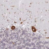 Anti-LARP1 antibody produced in rabbit