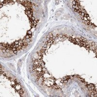 Anti-LARP1B antibody produced in rabbit 