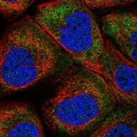 Anti-LARP1B antibody produced in rabbit 