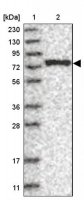 Anti-LARP7 antibody produced in rabbit HPA026842-100UL