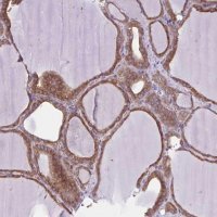 Anti-LARS antibody produced in rabbit HPA040881-100UL