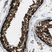 Anti-LBHD1 antibody produced in rabbit 