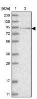Anti-LCA5 antibody produced in rabbit HPA029053-100UL