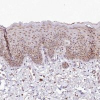 Anti-LDB1 antibody produced in rabbit 
