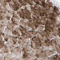 Anti-LDOC1L antibody produced in rabbit 