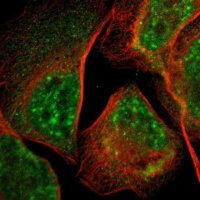 Anti-LDOC1L antibody produced in rabbit 