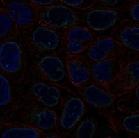 Anti-LEMD3 antibody produced in rabbit 
