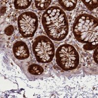 Anti-LGALS9 antibody produced in rabbit 