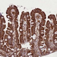 Anti-LGALS9 antibody produced in rabbit 