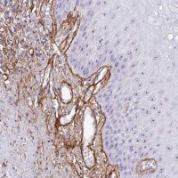 Anti-LHFP antibody produced in rabbit 